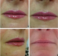 /album/fotogalerie/rty-ivet-24-3-2017-2-jpg/